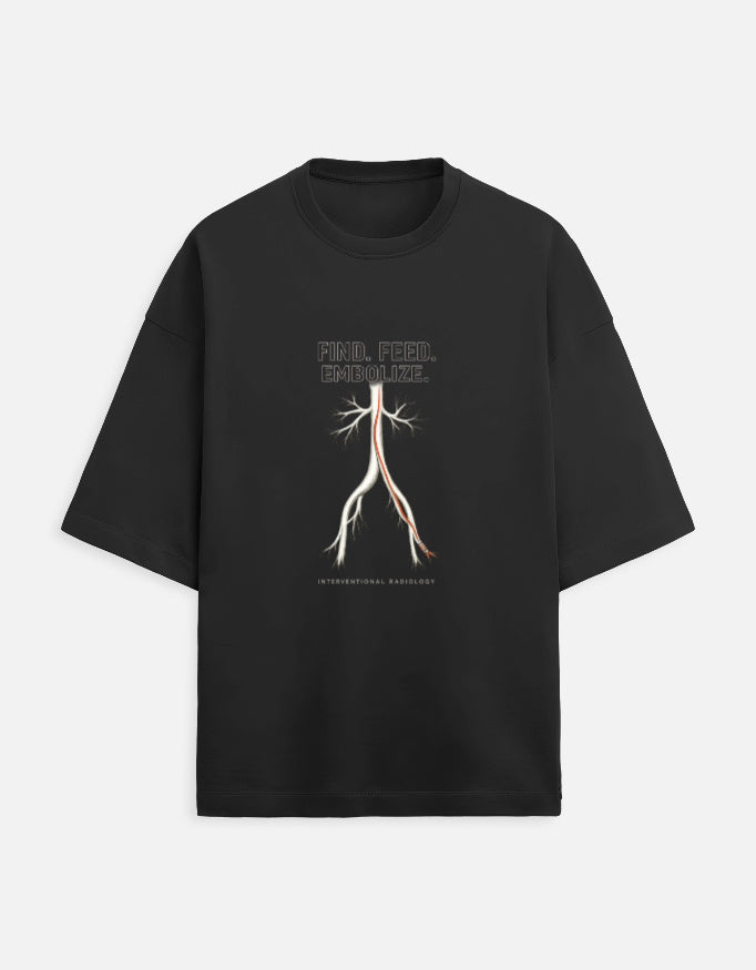 Black — Find. Feed. Embolize. interventional radiology t-shirt, front view